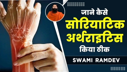 जाने कैसे सोरियाटिक अर्थराइटिस (Psoriatic Arthritis) किया ठीक  Swami Ramdev