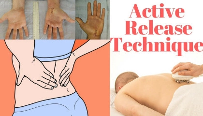 5 Active Release Technique Benefits, Including Lowered Pain
