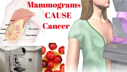 Mammograms CAUSE Cancer – The Best Prevention is Getting More of THIS Nutrient