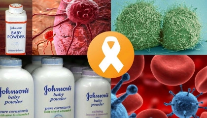 NBC J&J ordered to pay $72M for cancer death linked their talcum powder