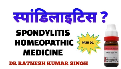 spondylitis treatment  spondylitis homeopathic medicine in hindi
