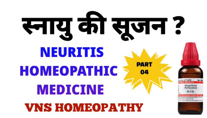 स्नायु दर्द का इलाज  neuritis treatment  neuritis homeopathy part 04
