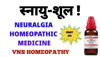 स्नायु शूल का इलाज  neuralgia treatment  neuralgia homeopathy medicine part 04