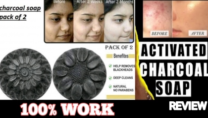 Skin whitening soap review  best skin whitening soap in india  charcoal soap