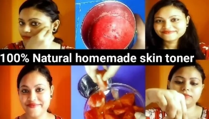 100% natural Homemade skin toner for skin whitening, pimples,dark spots
