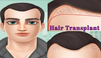 ASMR Hair Transplant ।। Hair Care Animation