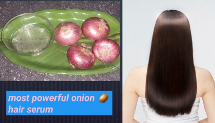 onion hair serum for long hair and loss hair