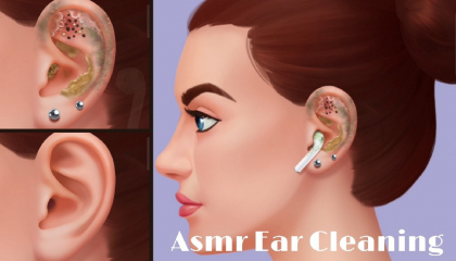 Asmr Ear Cleaning