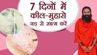 7 दिनों में कील मुँहासे (Pimples, Acne) जड़ से खत्म करें  Swami Ramdev