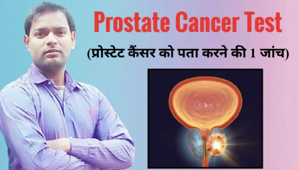 पुरुषों में प्रॉस्टेट कैंसर को पता करने की एक सही जांच ।