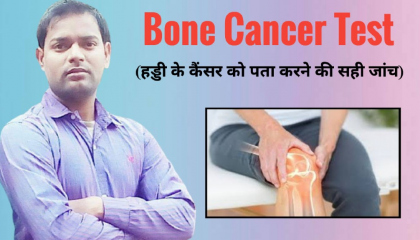 हड्डियों के कैंसर को पता करने की सही जांच ।