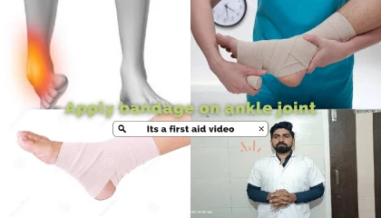 एंकल ज्वाइंट पर गर्म पट्टी बांधने का तरीका। Apply Crepe Bandage On Ankle Joint.