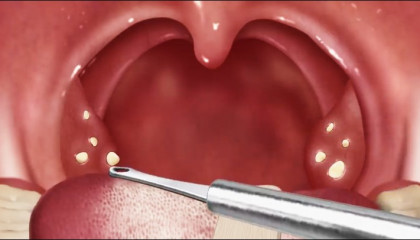 asmr hospital teeth surgery
