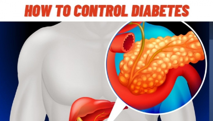How to control Diabetes mellitus naturally Home remedies tips in Hindi